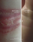 Before and After photos showing a severe rash before and clear skin after labelled with Before Coco Oat and After Coco Oat including a notation that Real Customer Photos shared with permission